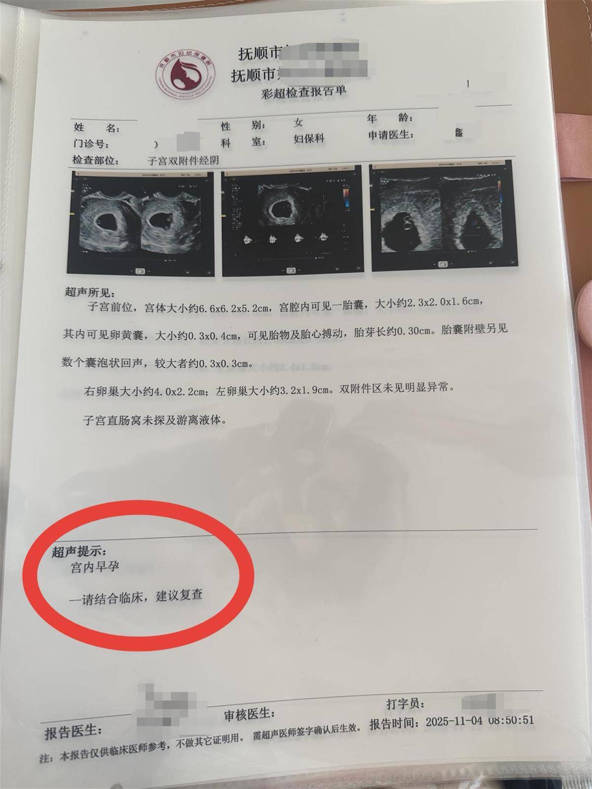 怎么开通皇冠信用开户_辽宁一孕妇两个月内从一胎变四胞胎怎么开通皇冠信用开户，每次产检发现多出一胎，医生：系同卵四胞胎，概率1300万至1500万分之一