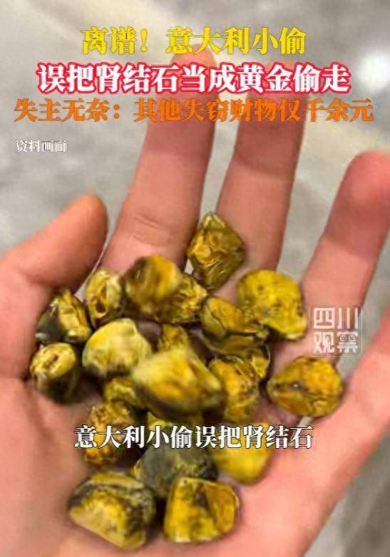 皇冠信用网代理注册_小偷误将肾结石当黄金偷走皇冠信用网代理注册，失主：两块肾结石用盒子装着，小偷以为那是值钱的黄金